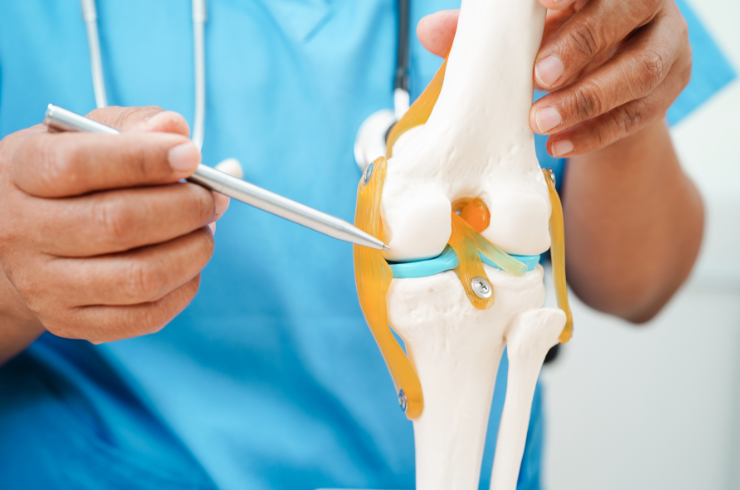 Joint Replacement Surgery
